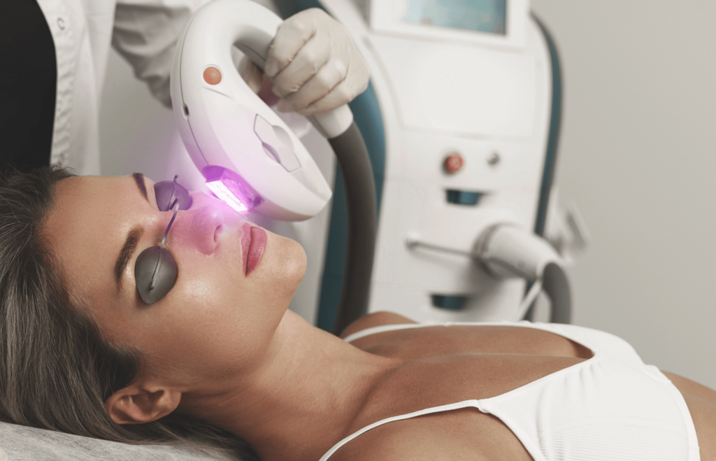 Femme recevant un traitement facial à la lumière pulsée intense (IPL) dans une clinique esthétique, portant des lunettes de protection.