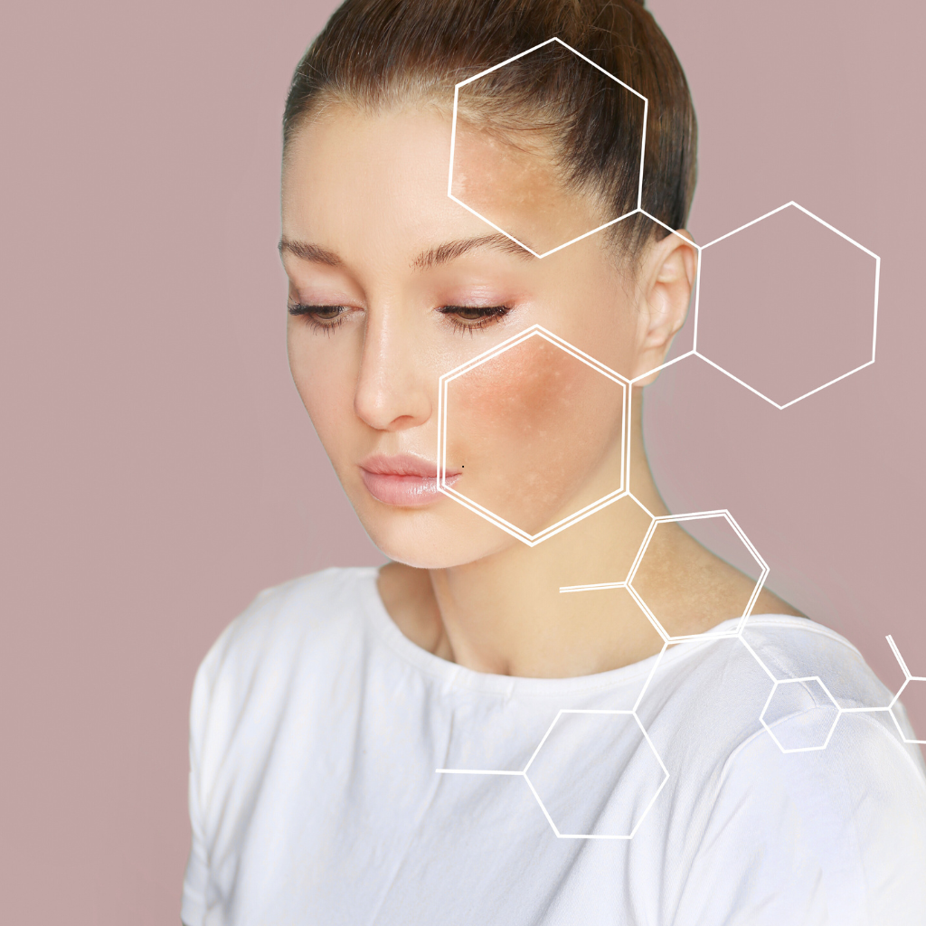 les biens fait de l'acide hyaluronique sur la peau leden centre jossigny et lieusaint